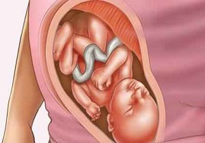تقویم بارداری هفته به هفته/ هفته 26 قد جنین به اندازه پیازچه است