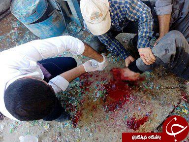 ماجرای کارگری که انگشتان پای خود را از دست داد + عکس (18+)
