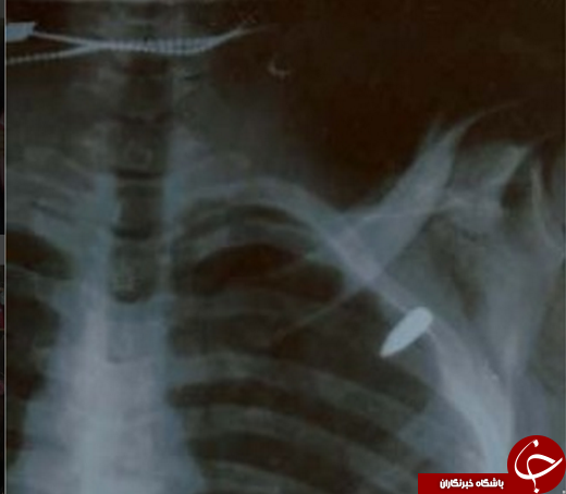 گلوله در نزدیک ترین فاصله به قلب پرسپولیسی متعصب +عکس