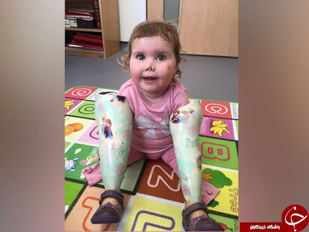 ساخت عروسک هایی از جنس بیماری یک دختر