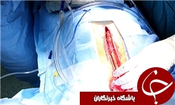 نایب رئیس مجلس در اتاق عمل + تصاویر