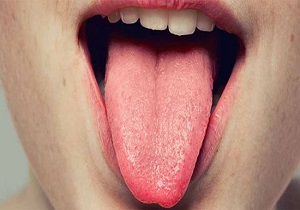 نکاتی که زبان شما درباره سلامت‌تان می‌گوید