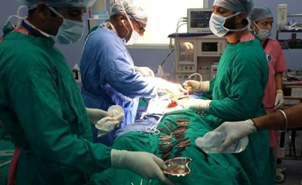 40 چاقوی فلزی بلعیده شده از معده بیمار هندی خارج شد! + عکس