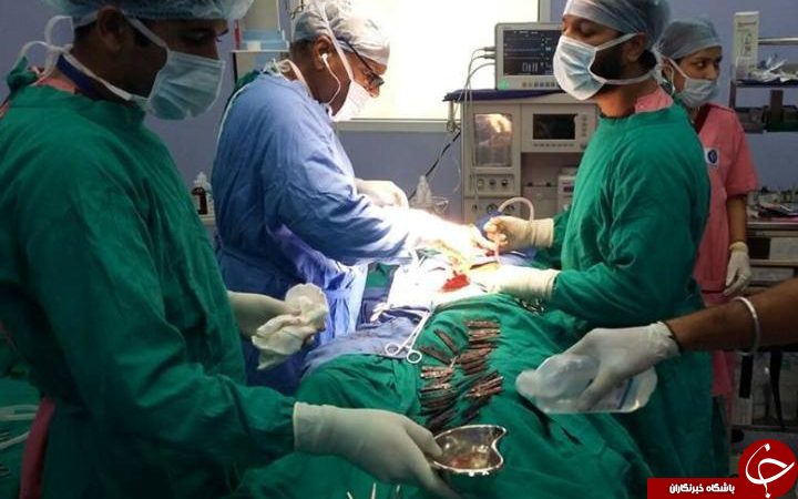 40 عدد چاقو در معده