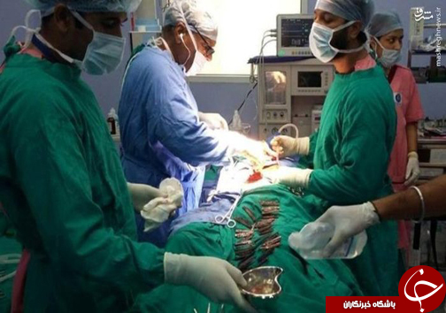 تصاویر/ 40 چاقو در معده بیمار!