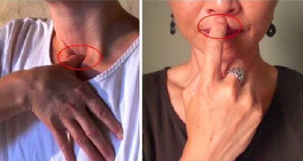 توقف سکسکه با فشار دادن این نقاط بدن+عکس