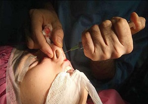 هشدار به کسانی که دنبال زیبایی هستند