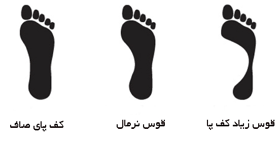 تاثیر پارکت و سرامیک در ایجاد صافی کف پای کودکان