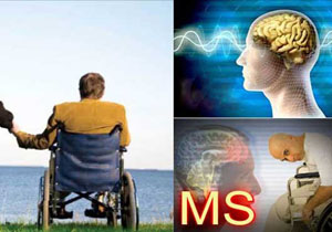 موج خطرناک MS در راه است