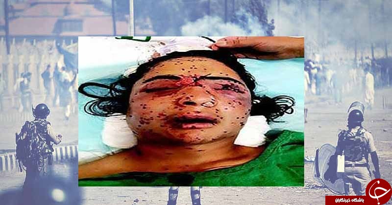 گلوله&zwnj;های فلفل جایگزین گلوله&zwnj;های ساچمه&zwnj;ای در کشمیر/ ساچمه&zwnj;هایی که چشمان معترضان را کور کرد+تصاویر(18+)