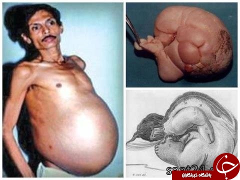 (تصاویر) عجیب ترین مردان جهان، از مردی که باردار شد تا مردی که فکر می کند مسیح است