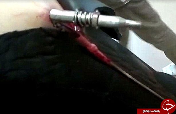 نجات معجزه آسای ماهیگیری که به خودش نِیزه زد!+ تصاویر و فیلم (16+)