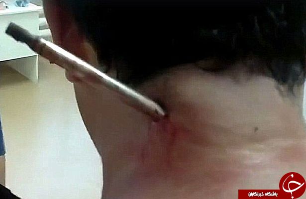 نجات معجزه آسای ماهیگیری که به خودش نِیزه زد!+ تصاویر و فیلم (16+)