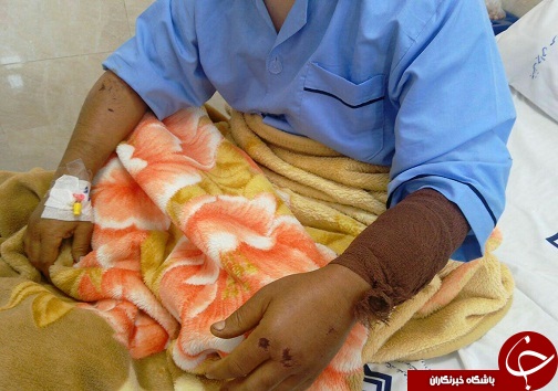 حمله سگ گرگی به یک مرد+عکس