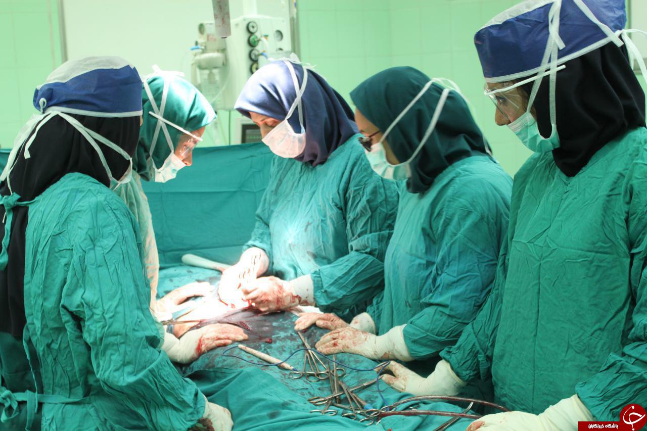 خارج کردن توده 8 کیلوگرمی از شکم خانم 50 ساله+ تصاویر
