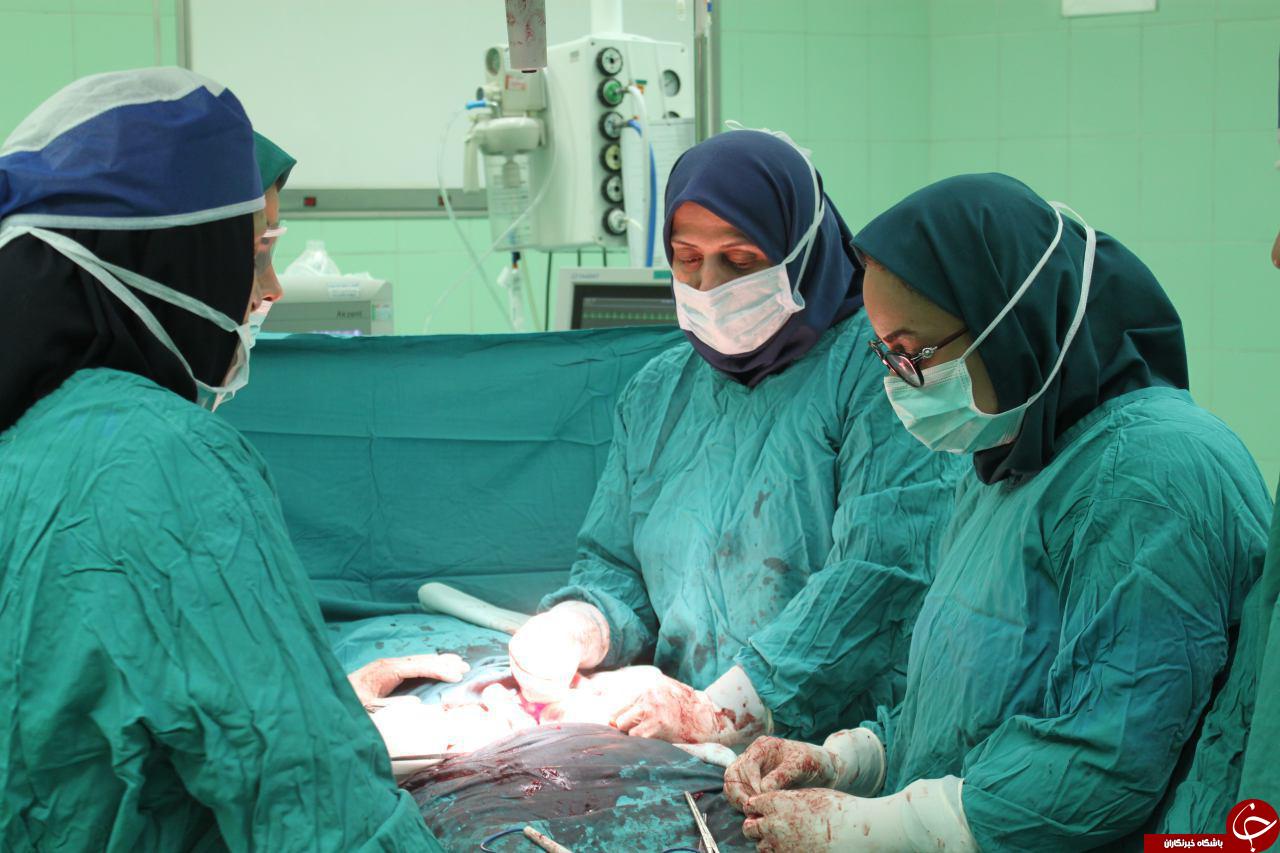 خارج کردن توده 8 کیلوگرمی از شکم خانم 50 ساله+ تصاویر
