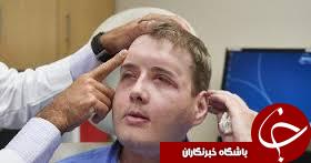 پیام امید آتش نشان فداکار پس  از عمل پیوند صورت