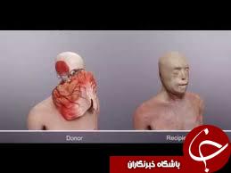 پیام امید آتش نشان فداکار پس  از عمل پیوند صورت