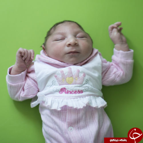 زیکا چطور ساختار جمجمه را به هم می&zwnj;ریزد؟+تصاویر