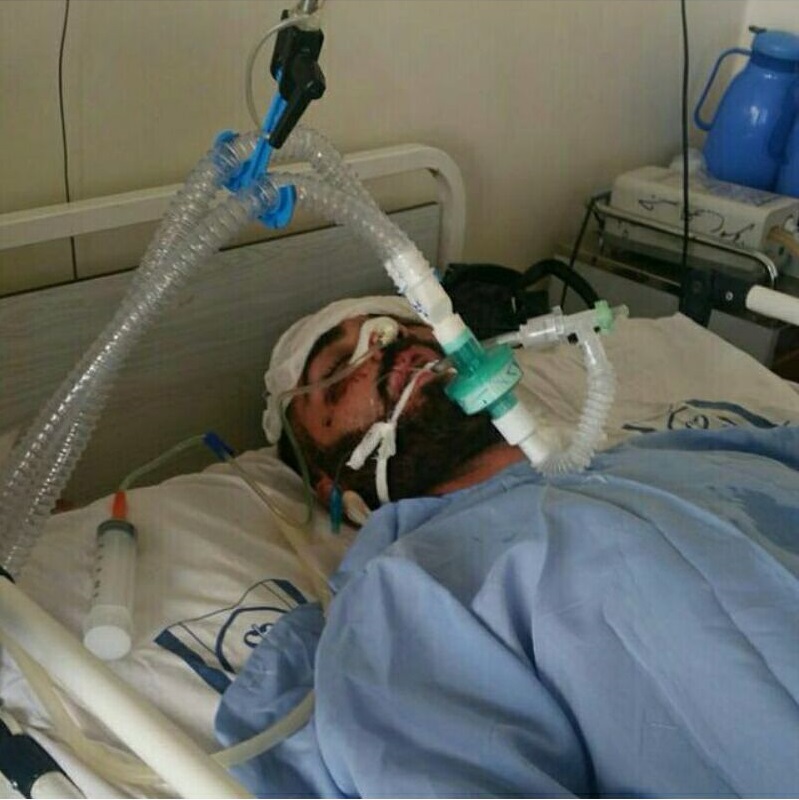 ملی پوش دوچرخه سواری به کما رفت