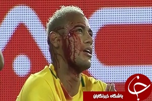 نیمار غرق در خون در برابر بولیوی + فیلم