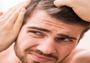 مصرف داروهای بدن سازی و سیگار از دلایل ریزش مو در مردان
