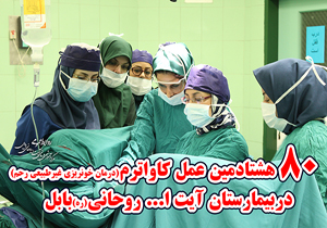 انجام 80 جراحی کاواترم تا کنون در بیمارستان آیت الله روحانی بابل