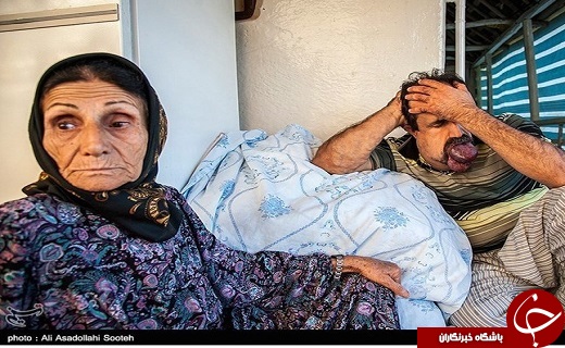 تصاویری از بیماری گشادی رگهای خونی اسماعیل