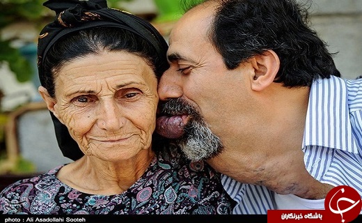 تصاویری از بیماری گشادی رگهای خونی اسماعیل