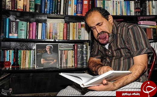 تصاویری از بیماری گشادی رگهای خونی اسماعیل