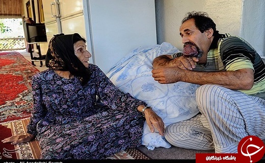 تصاویری از بیماری گشادی رگهای خونی اسماعیل