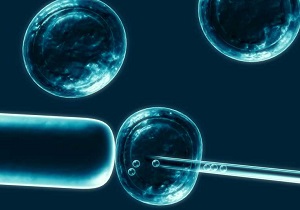 اولین پیوند سلول‌های بنیادی خونساز موفقیت‌آمیز بود