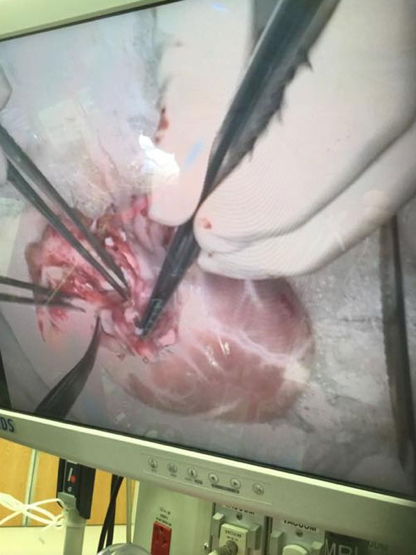 اقدام جالب والدین نوزاد 4 ماهه در هنگام عمل پیوند فرزندشان+تصاویر(16+)