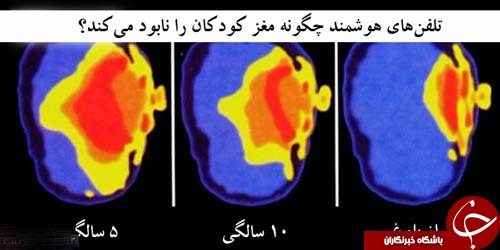 تبلت با مغز کودکان چه میکند؟ +عکس تبلت با مغز کودکان چه میکند؟ +عکس