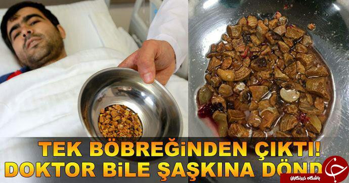 گواهینامه&zwnj;ی خلبانی/همسر بشار اسد/نام این نقاشی،/خیابان معروف لمبارد در سان&zwnj;فرانسیسکو،/مقدار سنگهای خارج شده/نوشابه مانع جذب کلسیم/رونمايي از تابلو نخل معرق/درخت پسته کوهی(بنه)/ولیعهد تایلند/پرایدی که دستگیره ندارد!/فرو رفتن خاور در چهارراه عدل قزوین/ شباهت تصویر یکی از شهدای