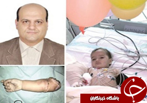 پیوند بازوی قطع شده یک کودک 13 ماهه اهوازی در شیراز