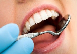 سهم هشت درصدی مراکز دولتی از ارائه خدمات دندانپزشکی