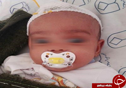 پدر شیشه ای نوزاد 4 ماهه را ضربه مغزی کرد +عکس