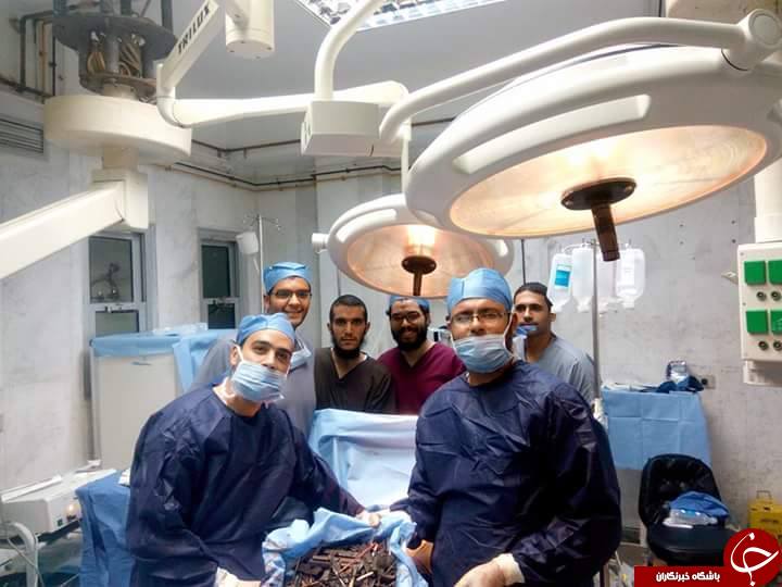 اشیاء عجیب که یک زن مصری بلعیده بود!+ تصاویر