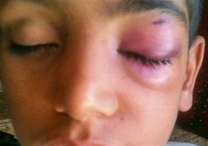 سلامت روان حلقه مفقوده استخدام / از تنبیه در آموزش&zwnj;وپرورش سوءاستفاده شده است