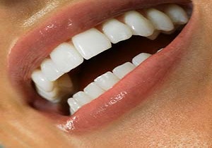 میکروب دهانتان کم است یا زیاد؟