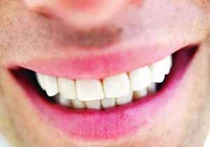 بهترین گزینه برای دندان‌هایی که از دست داده‌اید، چیست؟