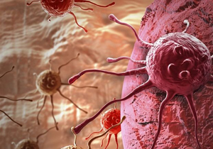 جلوگیری از تشکیل تومورهای بدخیم با روشی نوین