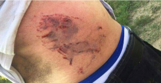 مهاجران طعمه سگ های وحشی مي شوند+ عکس18+