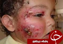 چالش جدید اهوازی ها/ زخم&zwnj;هایی که بوی نخاله می دهند!