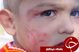 چالش جدید اهوازی ها/ زخم&zwnj;هایی که بوی نخاله می دهند!