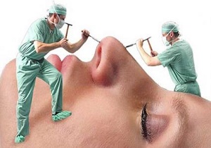 زیبایی، کیلویی چند؟