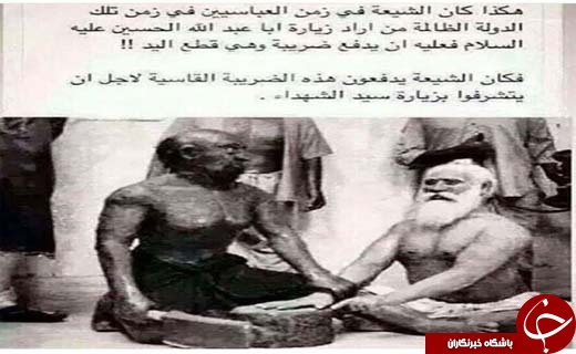زائرانی که برای زیارت بارگاه امام حسین(ع) مجبور به قطع دست شدند+عکس