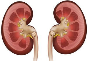 فارس بزرگترین مرکز پیوند کلیه در دنیا