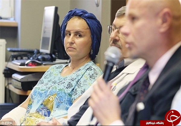تومور عجیب صورت دختر جوان +تصاویر